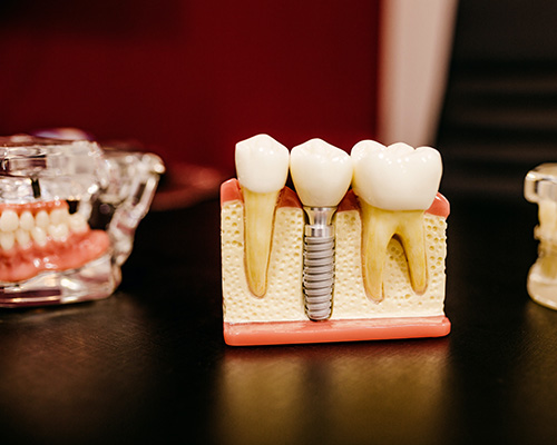 Best Dental Marketing Companies